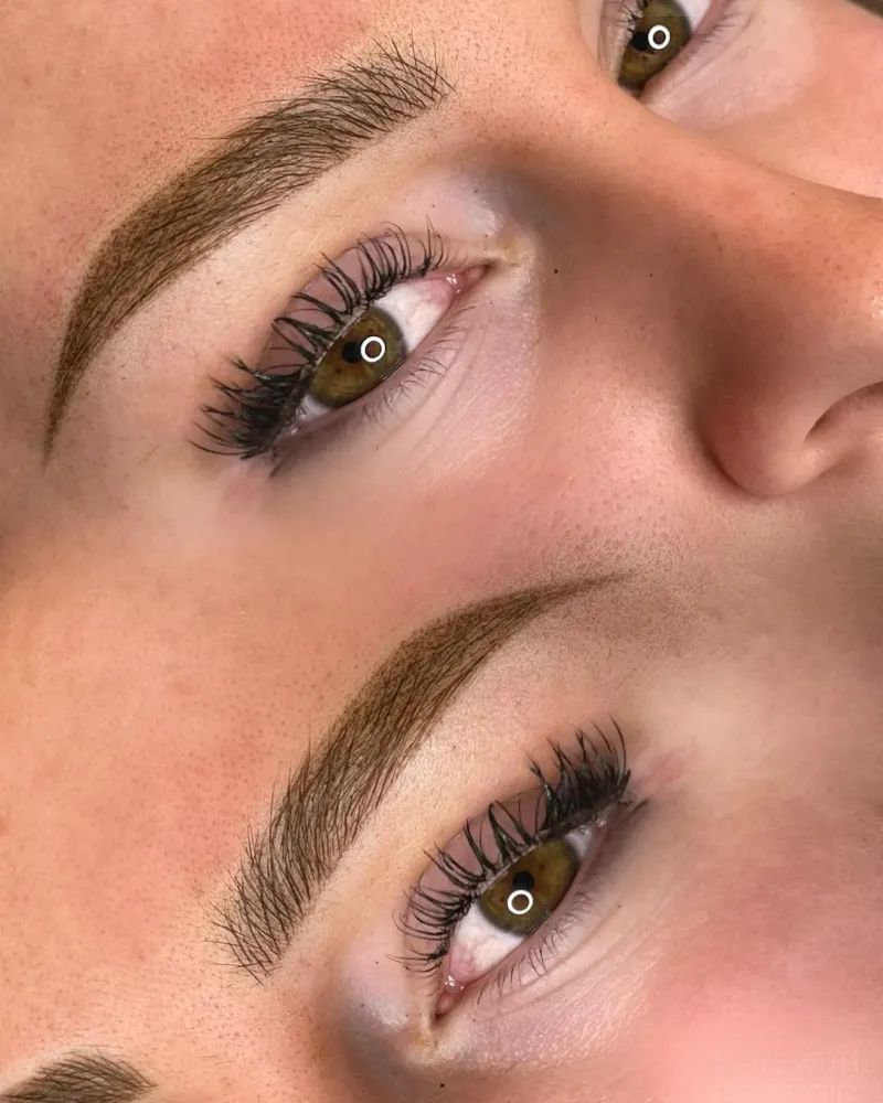 Soin esthétique de browlift